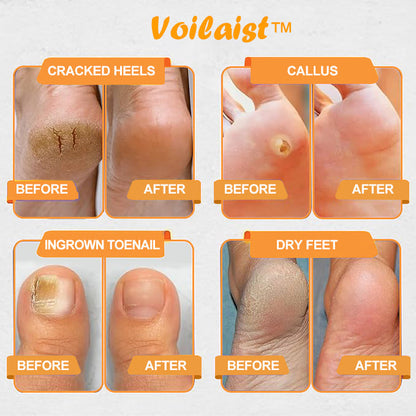 🐝Voilaist™ Bee Venom Lymphatic Drainage & Slimming Foot SoakBeads【Doctorrecommendation-For alllymphatic problems and obesity】